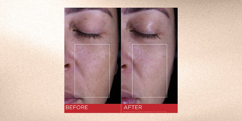 In-Article-do-you-need-spf-50_1